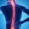 Bukan Sekadar Masalah Estetika, Kenali Gejala Awal Skoliosis dan Pentingnya Deteksi Dini