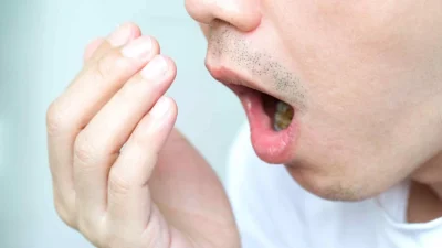 Sering Bikin Minder, Kenali 7 Penyebab Utama Bau Mulut Menurut Pakar Dokter Gigi