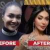 Denada Lakukan Oplas, Katanya Bukan untuk Cari Pasangan