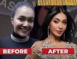 Denada Lakukan Oplas, Katanya Bukan untuk Cari Pasangan