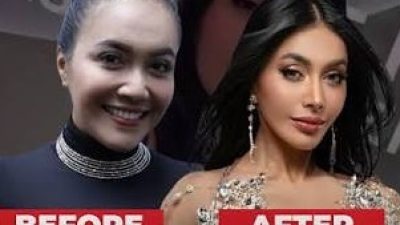 Denada Lakukan Oplas, Katanya Bukan untuk Cari Pasangan